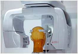 CBCT scan