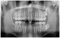 x-ray
