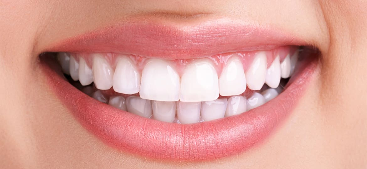 How to Get Rid of Blue Teeth - Here Is Some Teeth Whitening Tips