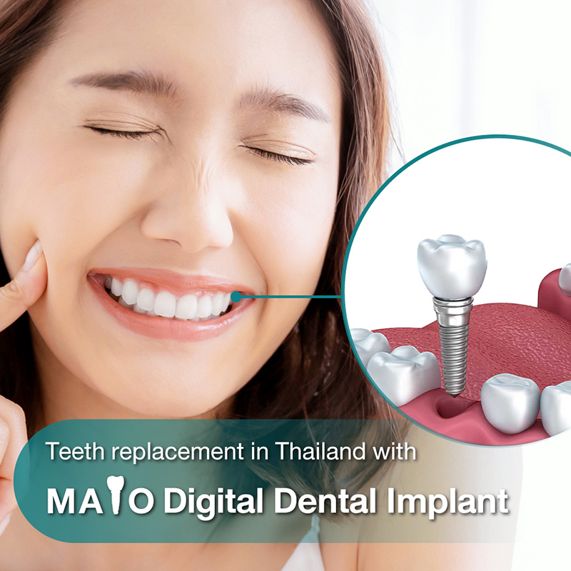 dental, dentist, dental clinic, dental bridges, dental cosmetic, dental crown, dental veneer, implants, invisalign, bangkok, sukhumvit, Thailand