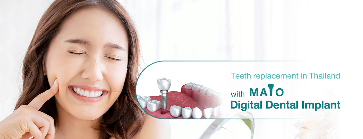 Dental Implants Overseas I Teeth Replacement Treatment in Thailand