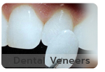 bangkok dental, dental bridge, dental clinic, dental cosmetic, dental crown, dental veneer, bangkok dentist, invisalign bangkok, laser tooth whitening, bangkok sukhumvit