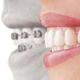 dental bangkok, dentist bangkok, dental clinic, dental bridges, dental cosmetic, dental crown, dental veneer, dental hospital, implant bangkok, invisalign bangkok, bangkok, sukhumvit