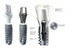 Premium Single Tooth Dental Implant