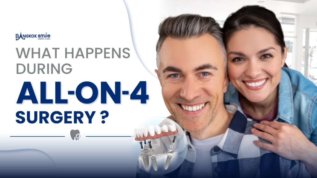 What Happens During All-on-4 Surgery?