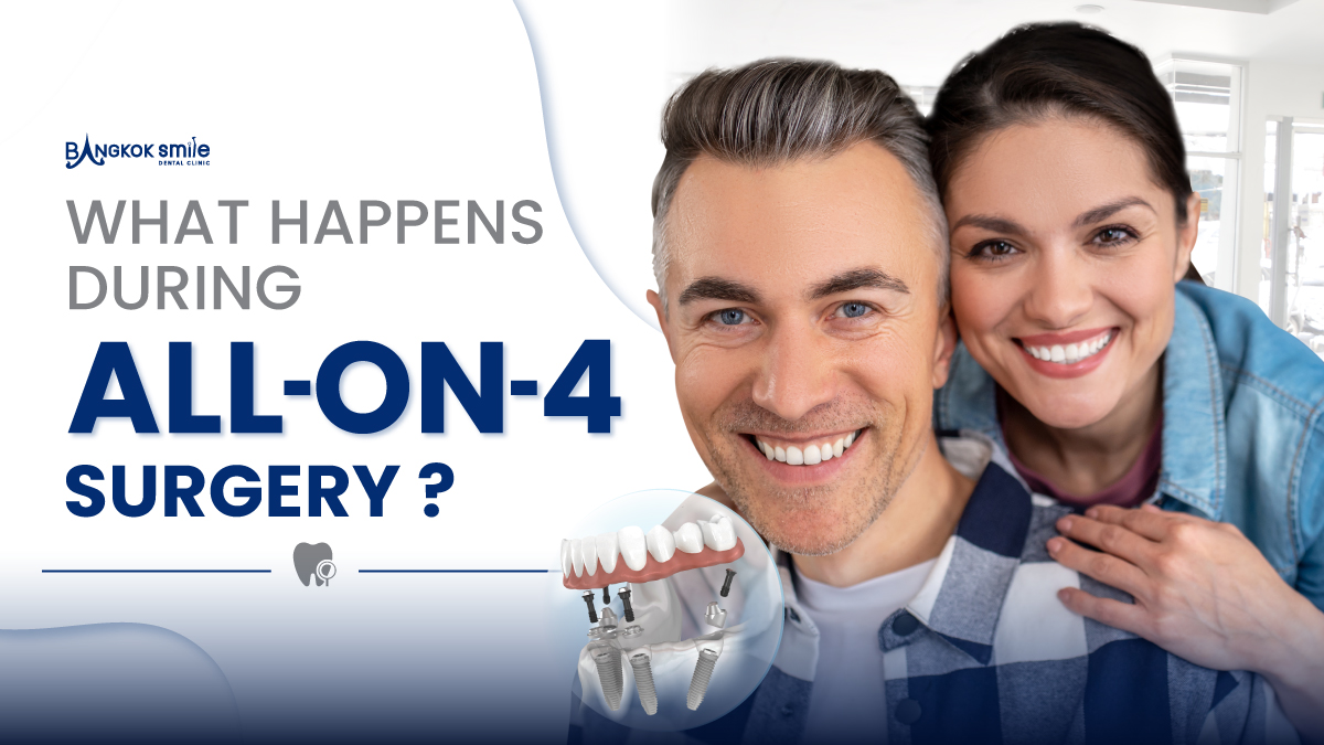 What Happens During All-on-4 Surgery?
